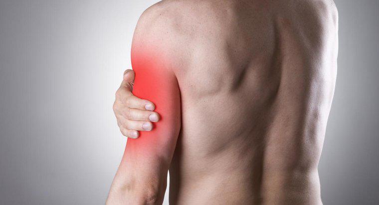 ¿Puede un nervio pinchado causar dolor en el brazo izquierdo?