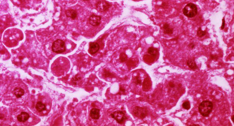 ¿Qué es la enfermedad del parénquima hepático?