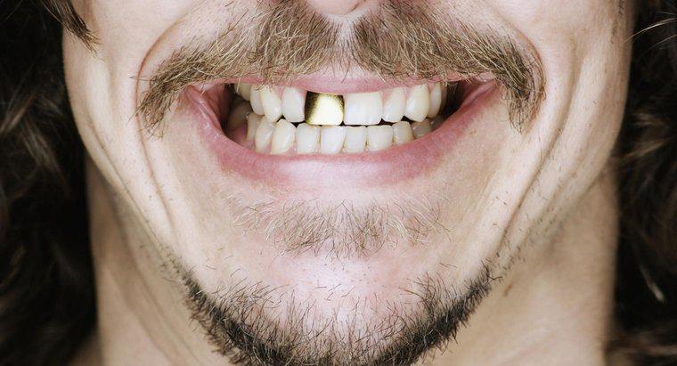 ¿Cómo se limpian los dientes de oro?