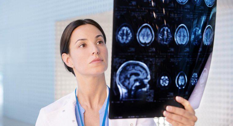 ¿Qué es un médico llamado que estudia el cerebro?
