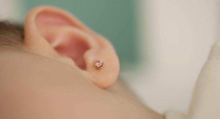 ¿Cómo puedo evitar los queloides que perforan los oídos?