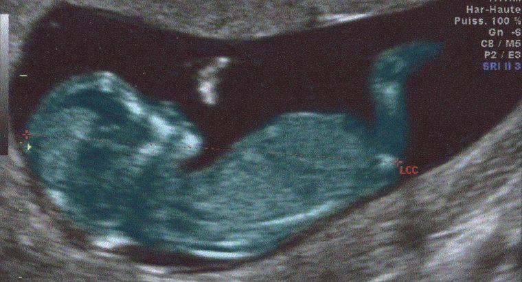 ¿Los bebés tienen agallas y colas cuando están en el útero?