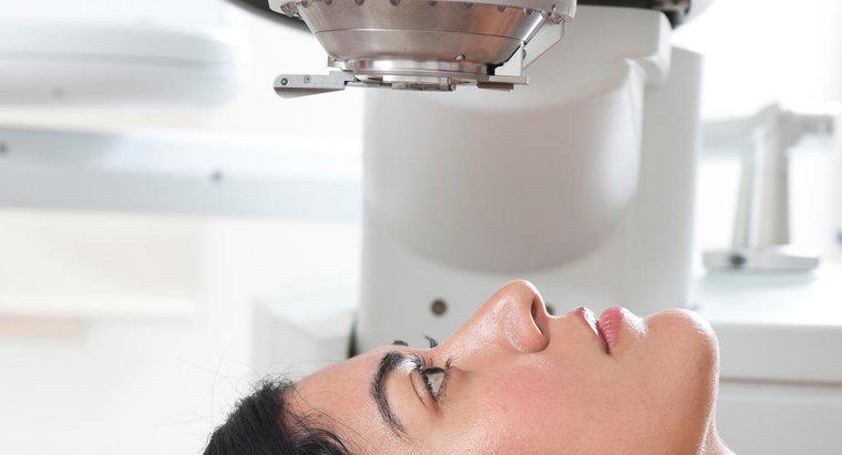 ¿Qué son los tratamientos con láser para el glaucoma?