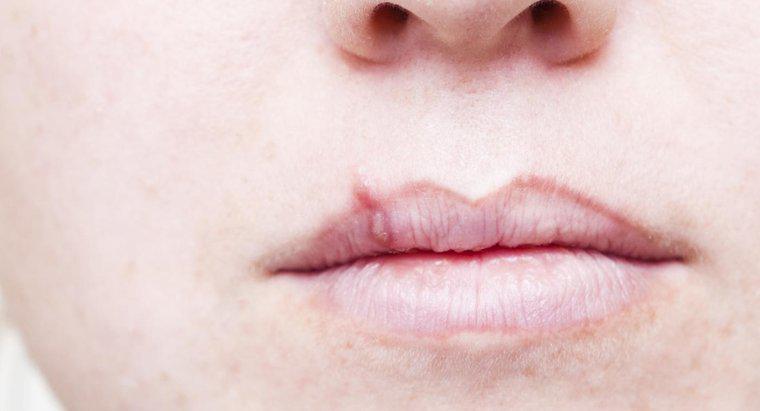 ¿Cuál es el primer signo de cáncer de labio?