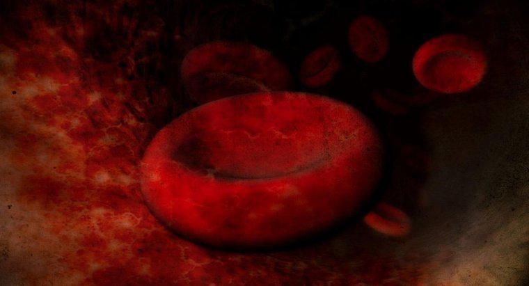 ¿Cuál es la causa de los glóbulos rojos agrandados?