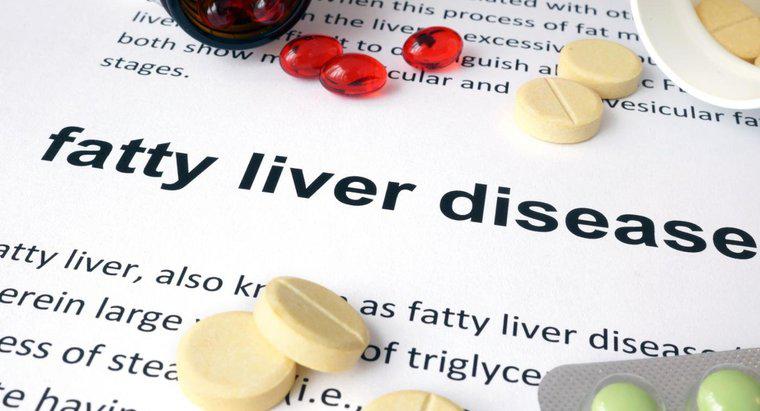 ¿Cuáles son los síntomas de un hígado graso?