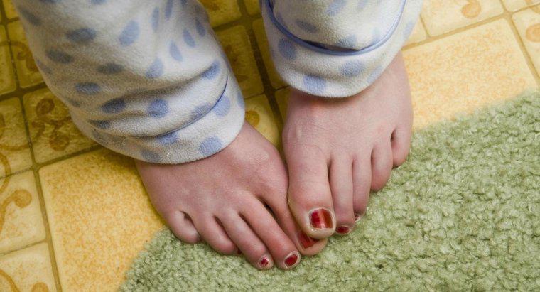 ¿Cuáles son algunos problemas comunes de uñas de los pies?