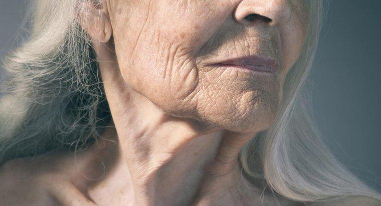 ¿Qué causa las arrugas prematuras de la piel?