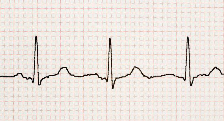 ¿Qué es un temblor del corazón?