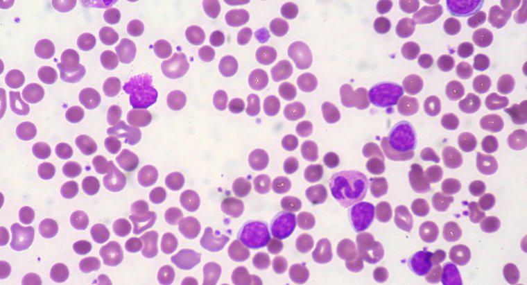 ¿Qué es un recuento normal de hemoglobina?
