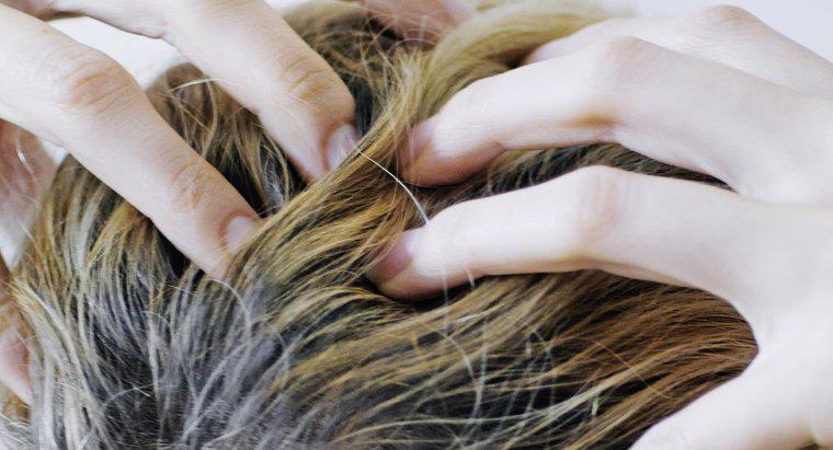 ¿Qué causa la picazón del cuero cabelludo y la pérdida del cabello?
