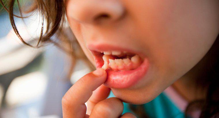 ¿Qué causa los dientes flojos en los adultos?