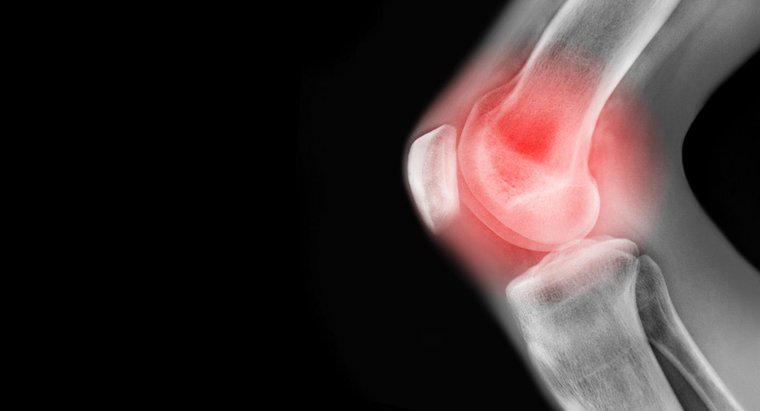 ¿Cuáles son algunas causas de dolor en la rodilla izquierda?