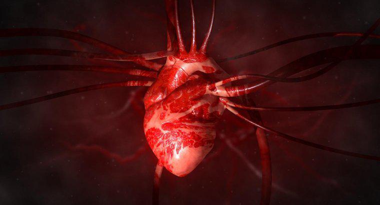 ¿Qué es una arteria agrandada del corazón?