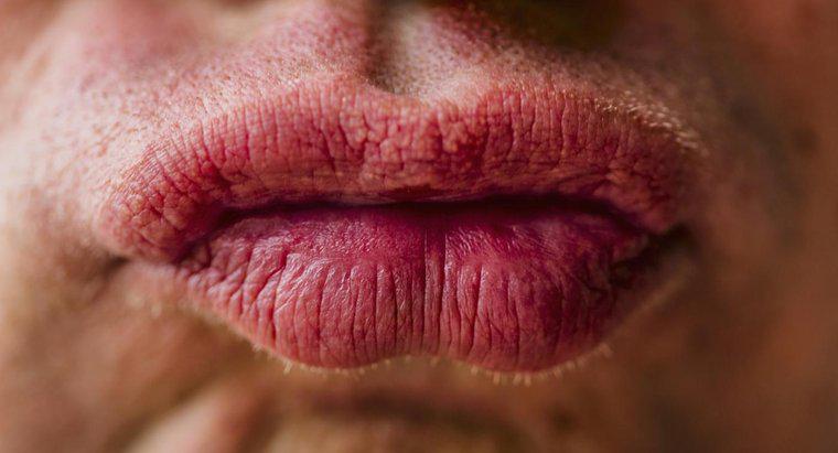 ¿Cómo se tratan los labios que están inflamados debido a una alergia?