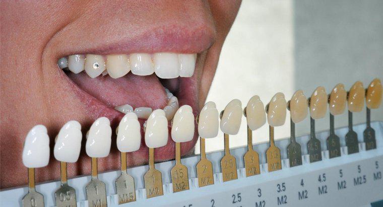 ¿Se pueden blanquear los dientes falsos?