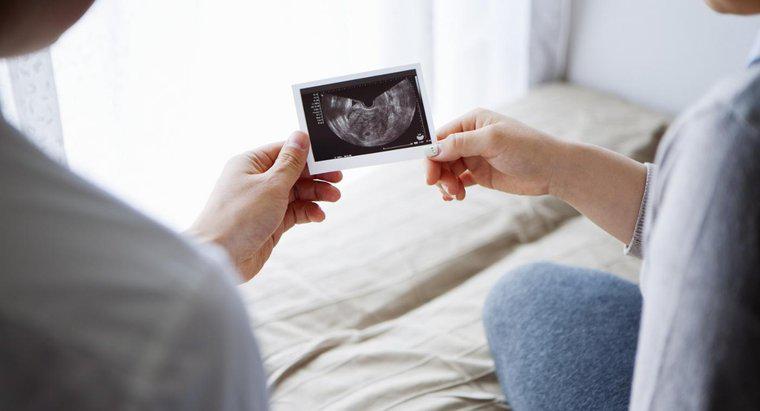 ¿Cómo se puede determinar si un feto es masculino o femenino?