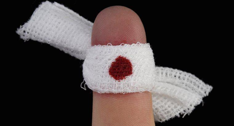 ¿Por qué mi dedo no deja de sangrar?