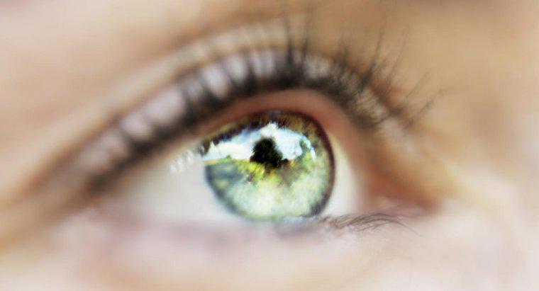¿Qué causa los flotadores negros en los ojos?