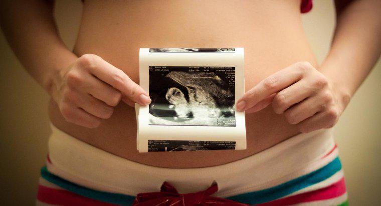 ¿Qué tan grande es mi útero en 13 semanas?