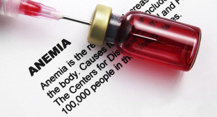 ¿Cómo se pueden analizar los niveles en el recuento sanguíneo para detectar anemia?