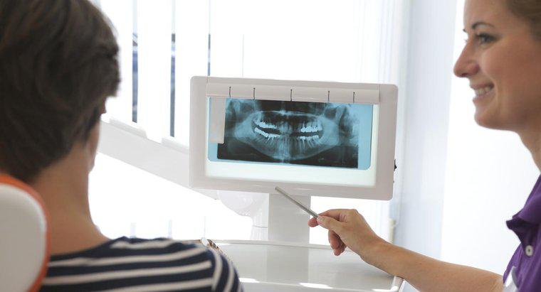 ¿Cuánto debo esperar pagar por los implantes dentales?